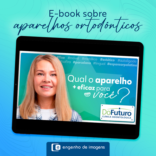 E-book sobre aparelhos ortodônticos